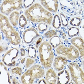 Anti-CC2D1A antibody used in IHC (Paraffin sections) (IHC-P). GTX64877