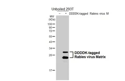 Anti-Rabies virus Matrix antibody [HL6365] used in Western Blot (WB). GTX648804