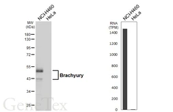Anti-Brachyury antibody [HL6369] used in Western Blot (WB). GTX648808
