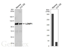 Anti-LONP1 antibody [HL6394] used in Western Blot (WB). GTX648833