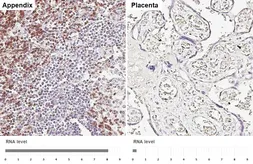 Anti-CD3 delta antibody [GT415] used in IHC (Paraffin sections) (IHC-P). GTX648838