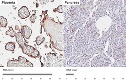 Anti-CD59 antibody [HL6401] used in IHC (Paraffin sections) (IHC-P). GTX648846
