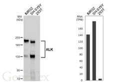 Anti-ALK antibody [HL6409] used in Western Blot (WB). GTX648854