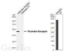 Anti-Thrombin Receptor antibody [HL6410] used in Western Blot (WB). GTX648855