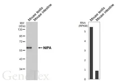 Anti-NIPA antibody [HL6411] used in Western Blot (WB). GTX648856