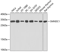 Anti-SMNDC1 antibody used in Western Blot (WB). GTX64887