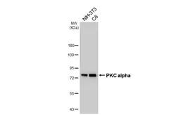 Anti-PKC alpha antibody [HL6427] used in Western Blot (WB). GTX648872