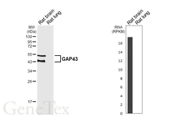 Anti-GAP43 antibody [HL6432] used in Western Blot (WB). GTX648877