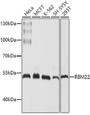 Anti-RBM22 antibody used in Western Blot (WB). GTX64888