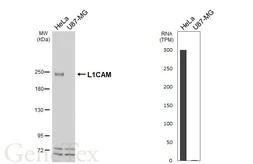 Anti-L1CAM antibody [HL6436] used in Western Blot (WB). GTX648881