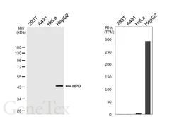 Anti-HPD antibody [HL6437] used in Western Blot (WB). GTX648882