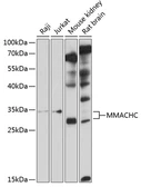 Anti-MMACHC antibody used in Western Blot (WB). GTX64889