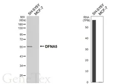 Anti-DFNA5 antibody [HL6448] used in Western Blot (WB). GTX648896