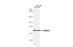 Anti-PARP2 antibody [HL6449] used in Western Blot (WB). GTX648897