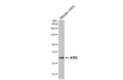 Anti-ATIC antibody [HL6465] used in Western Blot (WB). GTX648913