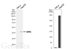 Anti-HPD antibody [HL6468] used in Western Blot (WB). GTX648916