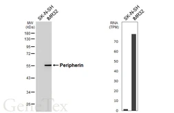 Anti-Peripherin antibody [HL6471] used in Western Blot (WB). GTX648919