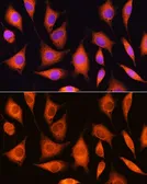 Anti-RRP4 antibody used in Immunocytochemistry/ Immunofluorescence (ICC/IF). GTX64892