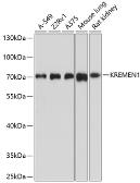 Anti-KREMEN1 antibody used in Western Blot (WB). GTX64893