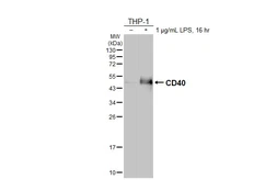 Anti-CD40 antibody [HL6485] used in Western Blot (WB). GTX648933