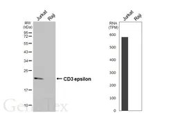 Anti-CD3 epsilon antibody [GT416] used in Western Blot (WB). GTX648937
