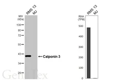 Anti-Calponin 3 antibody [HL6493] used in Western Blot (WB). GTX648949