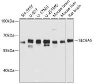 Anti-SLC6A5 antibody used in Western Blot (WB). GTX64896