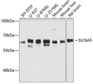 Anti-SLC6A5 antibody used in Western Blot (WB). GTX64896
