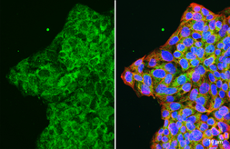 Anti-Nestin antibody [HL6511] used in Immunocytochemistry/ Immunofluorescence (ICC/IF). GTX648967