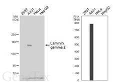 Anti-Laminin gamma 2 antibody [HL6517] used in Western Blot (WB). GTX648973