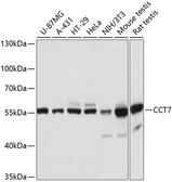 Anti-TCP1 eta antibody used in Western Blot (WB). GTX64898