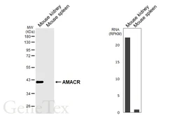 Anti-AMACR antibody [HL6548] used in Western Blot (WB). GTX649018