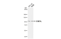 Anti-CSE1L antibody [HL6555] used in Western Blot (WB). GTX649025