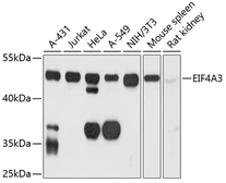 Anti-EIF4A3 antibody used in Western Blot (WB). GTX64904