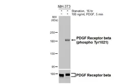 Anti-PDGF Receptor beta (phospho Tyr1021) antibody [HL6575] used in Western Blot (WB). GTX649045