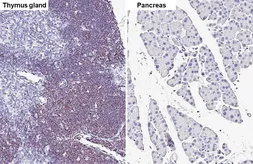 Anti-GFI1 antibody [HL6576] used in IHC (Paraffin sections) (IHC-P). GTX649046