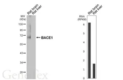Anti-BACE1 antibody [HL6578] used in Western Blot (WB). GTX649048