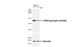 Anti-STING (phospho Ser366) antibody [HL6579] used in Western Blot (WB). GTX649049