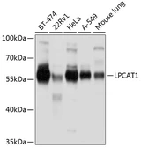 Anti-LPCAT1 antibody used in Western Blot (WB). GTX64905