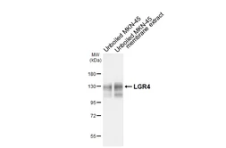 Anti-LGR4 antibody [HL6583] used in Western Blot (WB). GTX649053