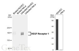 Anti-VEGF Receptor 1 antibody [HL6585] used in Western Blot (WB). GTX649055