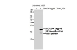 Anti-Oropouche virus NSs protein antibody [HL6587] used in Western Blot (WB). GTX649057