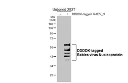 Anti-Rabies virus Nucleoprotein antibody [HL6590] used in Western Blot (WB). GTX649060