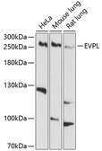 Anti-Envoplakin antibody used in Western Blot (WB). GTX64908