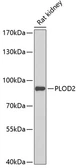 Anti-PLOD2 antibody used in Western Blot (WB). GTX64917