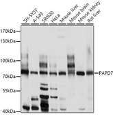 Anti-TRF41 antibody used in Western Blot (WB). GTX64928