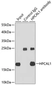 Anti-HPCAL1 antibody used in Immunoprecipitation (IP). GTX64929