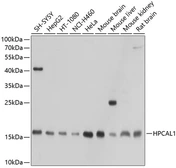 Anti-HPCAL1 antibody used in Western Blot (WB). GTX64929