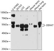 Anti-DDX47 antibody used in Western Blot (WB). GTX64931