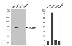 Anti-PARP9 antibody [HL6616] used in Western Blot (WB). GTX649316